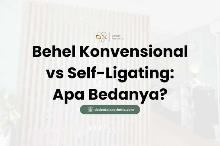 Behel Konvensional vs Self-Ligating: Apa Bedanya? - DX Dental Aesthetic