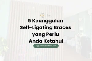 5 Keunggulan Self-Ligating Braces yang Perlu Anda Ketahui - DX Dental Aesthetic