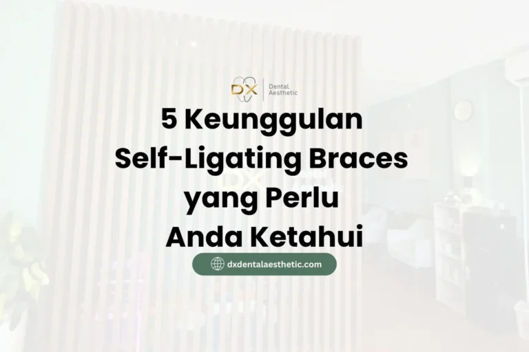 5 Keunggulan Self-Ligating Braces yang Perlu Anda Ketahui - DX Dental Aesthetic