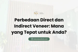 Perbedaan Direct dan Indirect Veneer Mana yang Tepat untuk Anda? - DX Dental Aesthetic