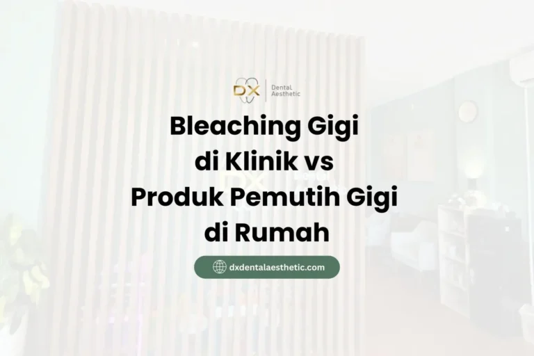 Bleaching Gigi di Klinik vs. Produk Pemutih Gigi di Rumah - DX Dental Aesthetic