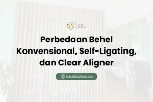 Perbedaan Behel Konvensional, Self-Ligating, dan Clear Aligner - DX Dental Aesthetic
