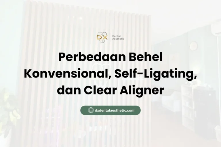 Perbedaan Behel Konvensional, Self-Ligating, dan Clear Aligner - DX Dental Aesthetic