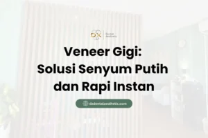 Veneer Gigi Solusi Senyum Putih dan Rapi Instan - DX Dental Aesthetic