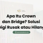 Apa Itu Crown dan Bridge? Solusi Gigi Rusak atau Hilang - DX Dental Aesthetic