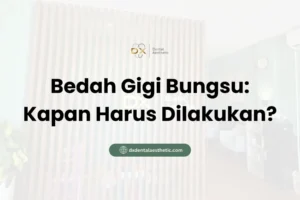 Bedah Gigi Bungsu Kapan Harus Dilakukan? - DX Dental Aesthetic