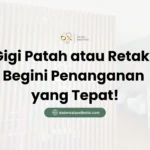 Gigi Patah atau Retak? Begini Penanganan yang Tepat - DX Dental Aesthetic