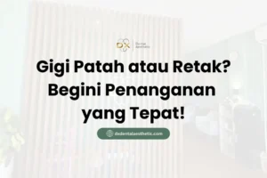 Gigi Patah atau Retak? Begini Penanganan yang Tepat - DX Dental Aesthetic