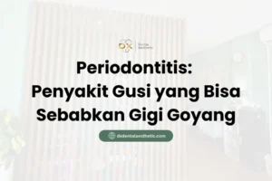 Periodontitis Penyakit Gusi yang Bisa Sebabkan Gigi Goyang - DX Dental Aesthetic