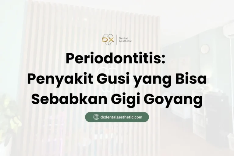Periodontitis Penyakit Gusi yang Bisa Sebabkan Gigi Goyang - DX Dental Aesthetic