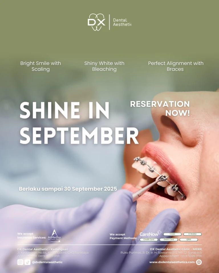 Promo DX Dental Aesthetic Bulan September 2025