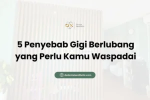5 Penyebab Gigi Berlubang yang Perlu Kamu Waspadai - DX Dental Aesthetic