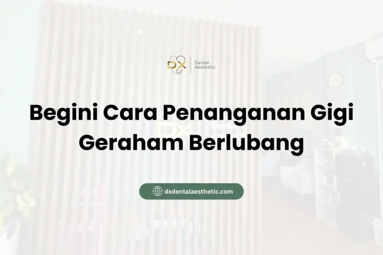 Begini Cara Penanganan Gigi Geraham Berlubang - DX Dental Aesthetic