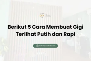 Berikut 5 Cara Membuat Gigi Terlihat Putih dan Rapi - DX Dental Aesthetic