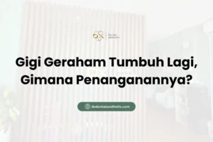 Gigi Geraham Tumbuh Lagi, Gimana Penanganannya? - DX Dental Aesthetic