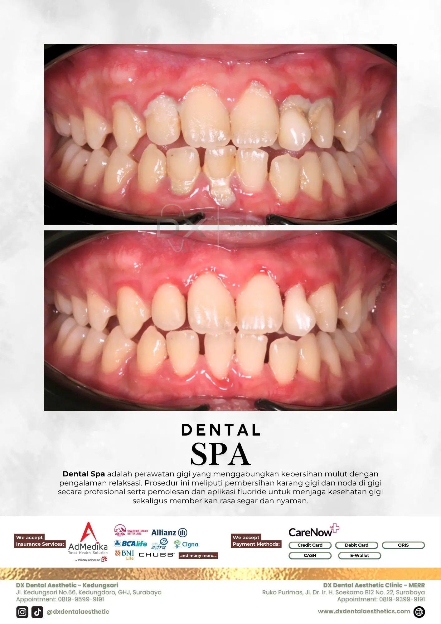 Katalog Treatment - DX Dental Aesthetic 02