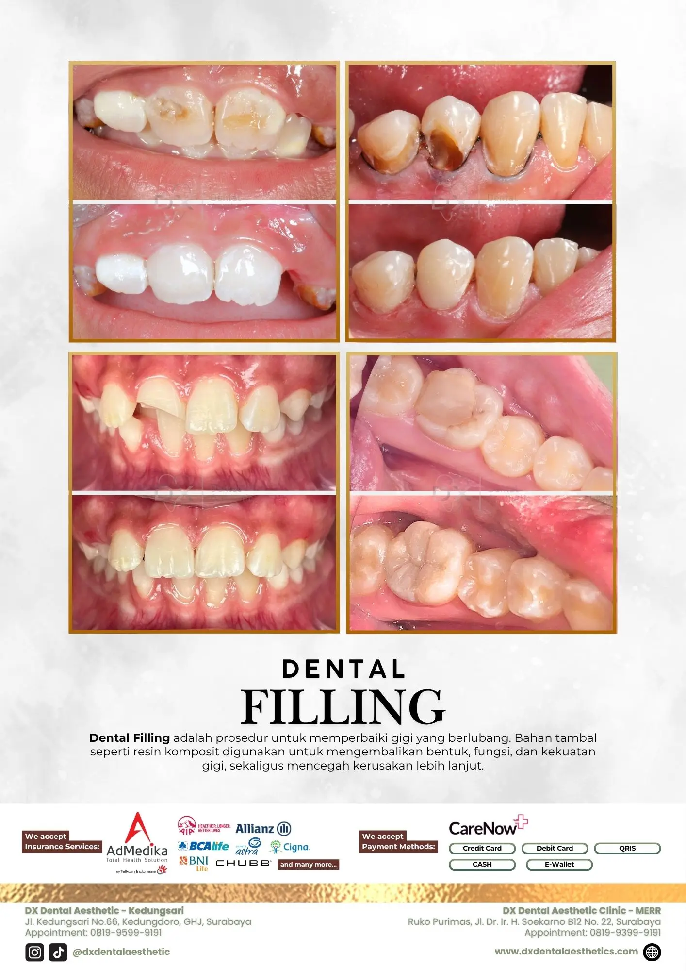 Katalog Treatment - DX Dental Aesthetic 05