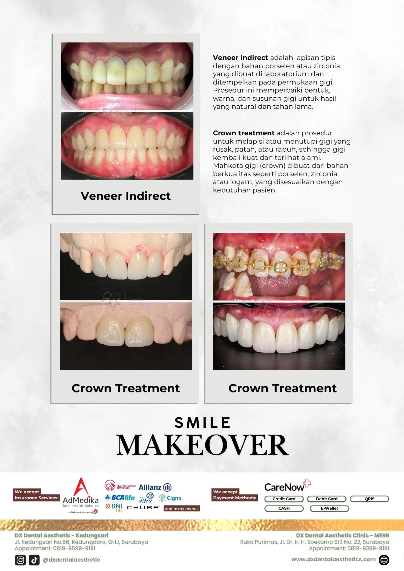 Katalog Treatment - DX Dental Aesthetic 06