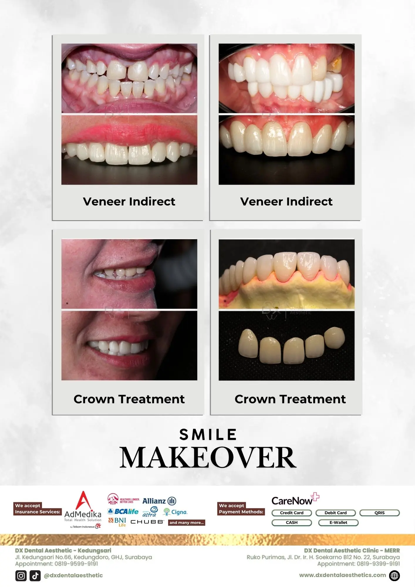 Katalog Treatment - DX Dental Aesthetic 07