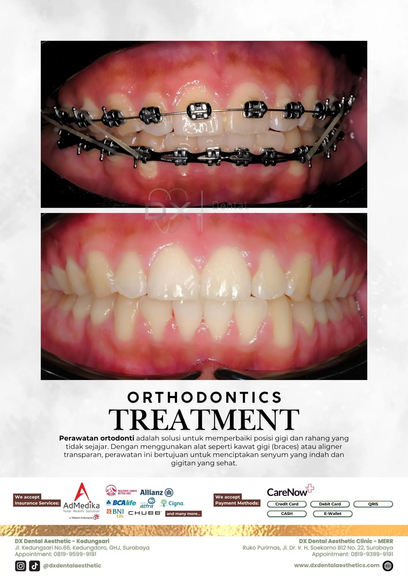 Katalog Treatment - DX Dental Aesthetic 09