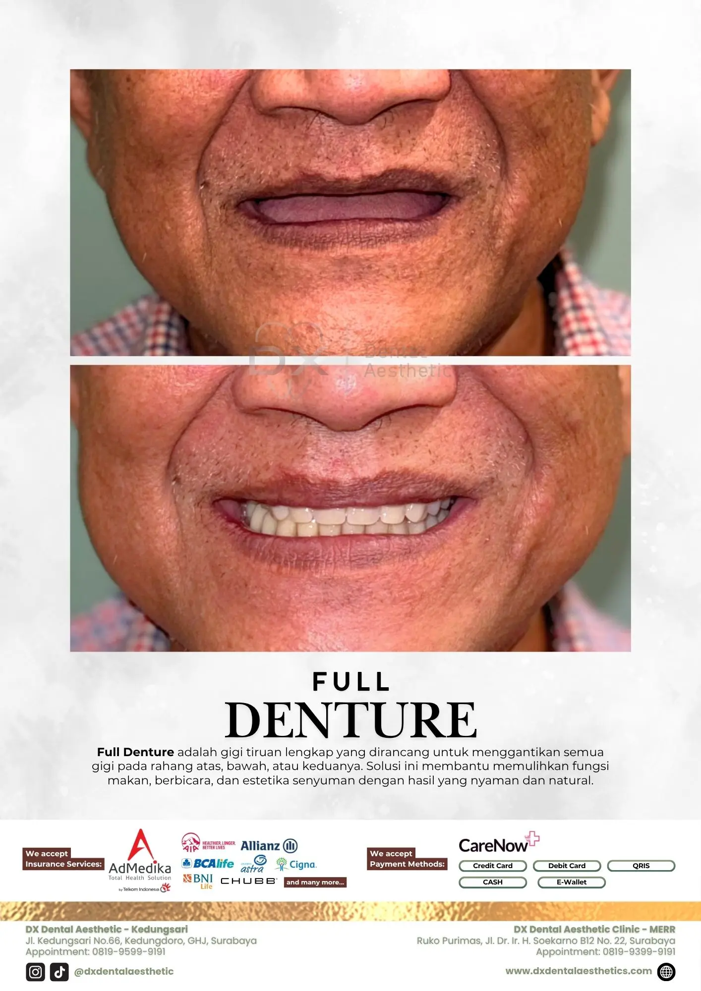 Katalog Treatment - DX Dental Aesthetic 10