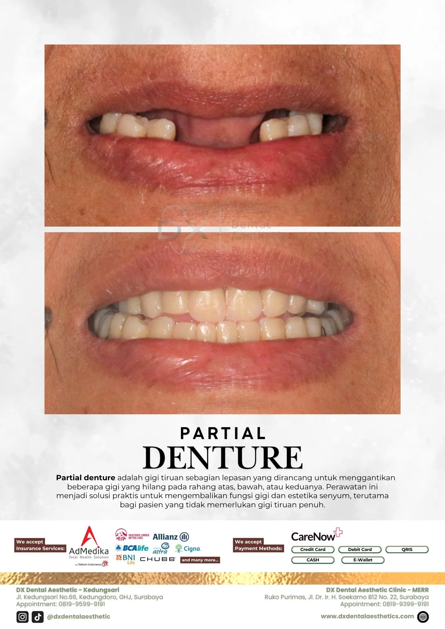Katalog Treatment - DX Dental Aesthetic 11