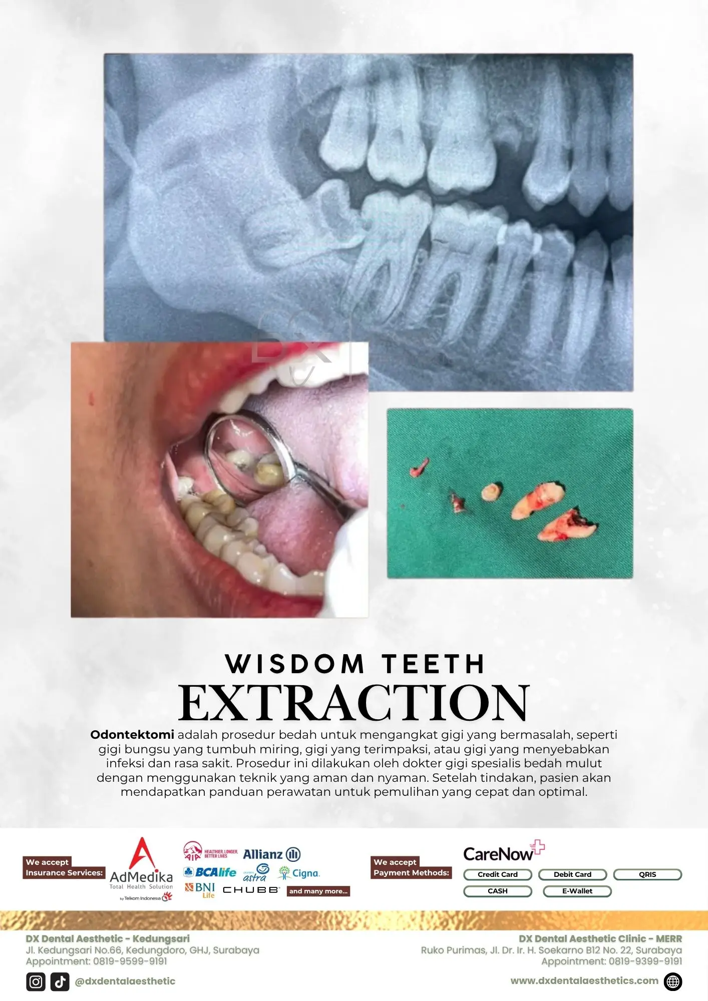 Katalog Treatment - DX Dental Aesthetic 12