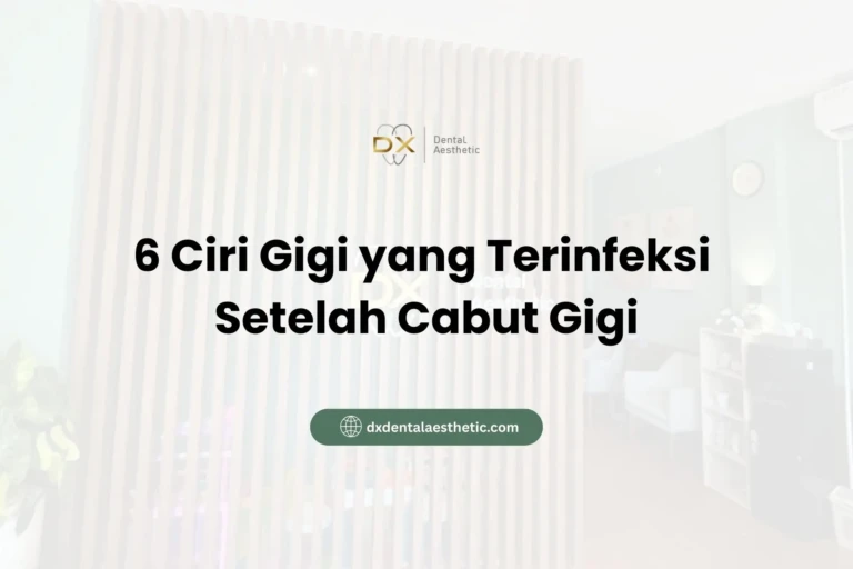 6 Ciri Gigi yang Terinfeksi Setelah Cabut Gigi - DX Dental Aesthetic