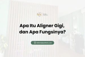 Apa Itu Aligner Gigi, dan Apa Fungsinya?