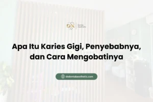 Apa Itu Karies Gigi, Penyebabnya, dan Cara Mengobatinya