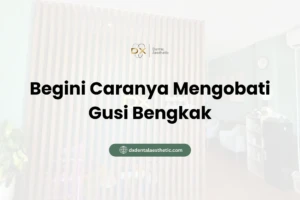 Begini Caranya Mengobati Gusi Bengkak - DX Dental Aesthetic