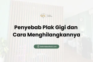 Penyebab Plak Gigi dan Cara Menghilangkannya - DX Dental Aesthetic