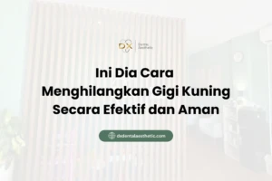 Ini Dia Cara Menghilangkan Gigi Kuning Secara Efektif dan Aman