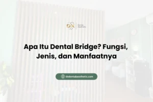 Apa Itu Dental Bridge? Fungsi, Jenis, dan Manfaatnya