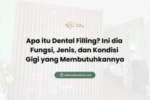 Apa itu Dental Filling? Ini dia Fungsi, Jenis, dan Kondisi Gigi yang Membutuhkannya