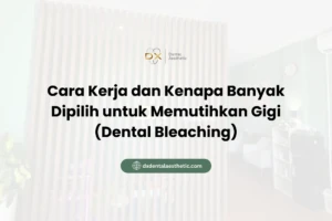 Cara Kerja dan Kenapa Banyak Dipilih untuk Memutihkan Gigi (Dental Bleaching)
