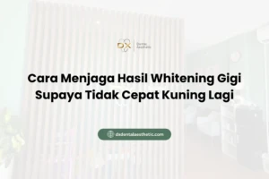 Cara Menjaga Hasil Whitening Gigi Supaya Tidak Cepat Kuning Lagi