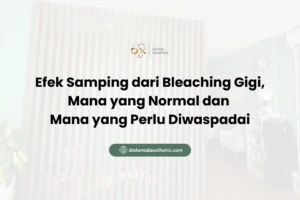 Efek Samping dari Bleaching Gigi, Mana yang Normal dan Mana yang Perlu Diwaspadai