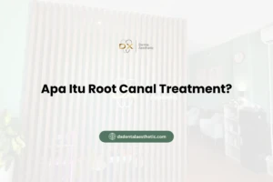 Apa Itu Root Canal Treatment?
