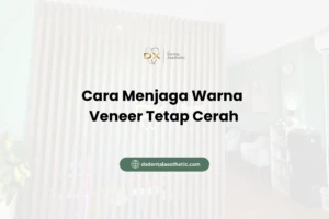 Cara Menjaga Warna Veneer Tetap Cerah