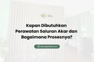 Kapan Dibutuhkan Perawatan Saluran Akar dan Bagaimana Prosesnya?