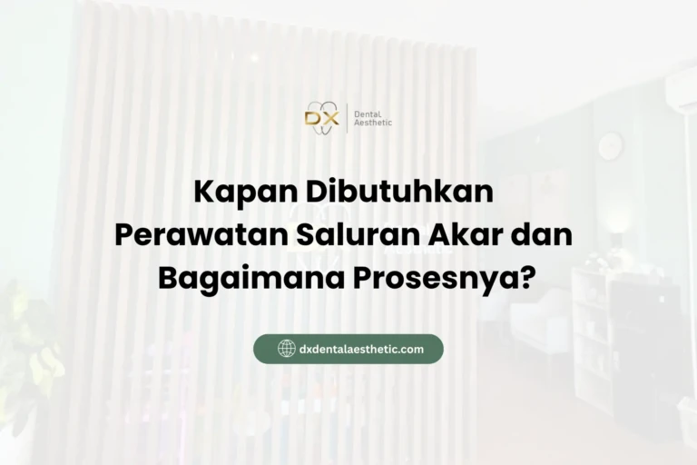 Kapan Dibutuhkan Perawatan Saluran Akar dan Bagaimana Prosesnya? - DX Dental Aesthetic