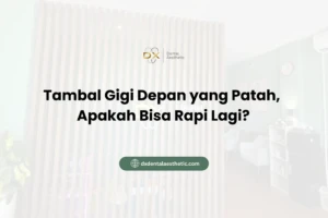 Tambal Gigi Depan yang Patah, Apakah Bisa Rapi Lagi?