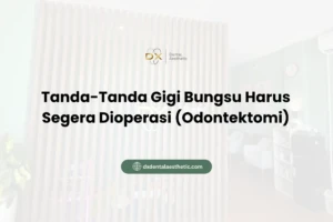 Tanda-Tanda Gigi Bungsu Harus Segera Dioperasi (Odontektomi)