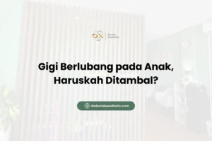 Gigi Berlubang pada Anak, Haruskah Ditambal?