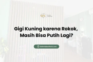 Gigi Kuning karena Rokok, Masih Bisa Putih Lagi?