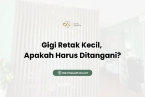 Gigi Retak Kecil, Apakah Harus Ditangani?
