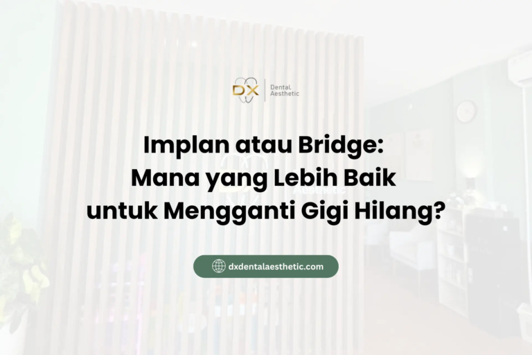 Implan atau Bridge Mana yang Lebih Baik untuk Mengganti Gigi Hilang - DX Dental Aesthetic