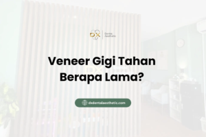 Veneer Gigi Tahan Berapa Lama? Ini Faktor yang Mempengaruhi Keawetannya