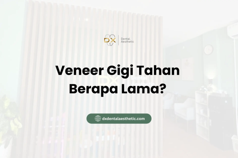 Veneer Gigi Tahan Berapa Lama - DX Dental Aesthetic